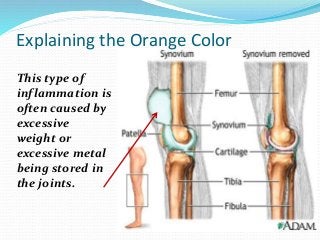 This type of
inflammation is
often caused by
excessive
weight or
excessive metal
being stored in
the joints.
Explaining the Orange Color
 