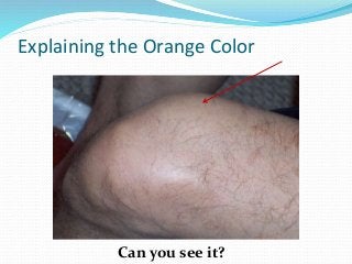 Explaining the Orange Color
Can you see it?
 