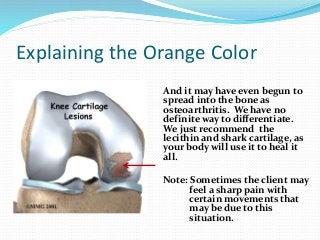 Explaining the Orange Color
And it may have even begun to
spread into the bone as
osteoarthritis. We have no
definite way to differentiate.
We just recommend the
lecithin and shark cartilage, as
your body will use it to heal it
all.
Note: Sometimes the client may
feel a sharp pain with
certain movements that
may be due to this
situation.
 