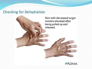 Checking for Dehydration
 