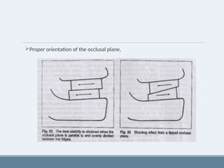 Proper orientation of the occlusal plane,
 