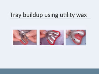 Tray buildup using utility wax
 