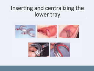 Inserting and centralizing the
lower tray
 