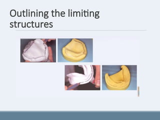 Outlining the limiting
structures
 