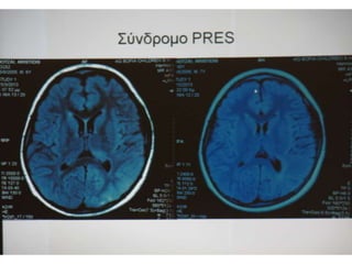 Παρουσιάσεις Πέμπτης   17-10-2013