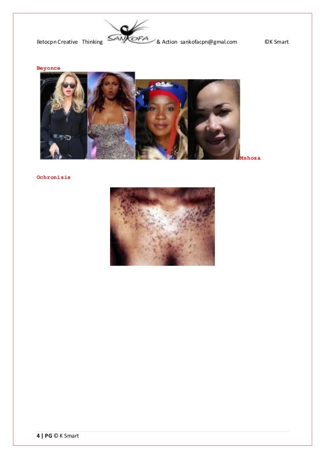 The Causes & Effects of The use of skin Bleaching Products Ce sbksd…