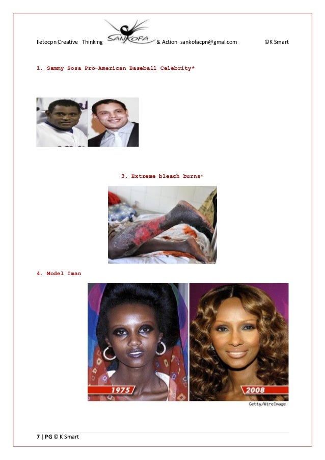 The Causes & Effects of The use of skin Bleaching Products Ce sbksd…