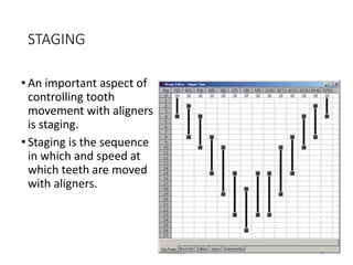 STAGING
• An important aspect of
controlling tooth
movement with aligners
is staging.
• Staging is the sequence
in which and speed at
which teeth are moved
with aligners.
102
Invisalign
 