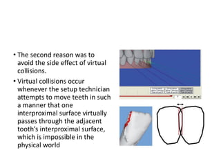 • The second reason was to
avoid the side effect of virtual
collisions.
• Virtual collisions occur
whenever the setup technician
attempts to move teeth in such
a manner that one
interproximal surface virtually
passes through the adjacent
tooth’s interproximal surface,
which is impossible in the
physical world
 