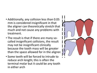 • Additionally, any collision less than 0.05
mm is considered insignificant in that
the aligner can theoretically stretch that
much and not cause any problems with
treatment.
• The result is that if there are many so-
called insignificant collisions, the result
may not be insignificant clinically
because the tooth mass will be greater
than the space allowed for in the aligner.
• Some teeth will be forced to intrude to
reduce arch length; this is often the
terminal molar but it could be any tooth
in either arch
 
