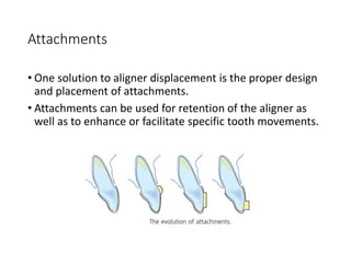 Attachments
• One solution to aligner displacement is the proper design
and placement of attachments.
• Attachments can be used for retention of the aligner as
well as to enhance or facilitate specific tooth movements.
 