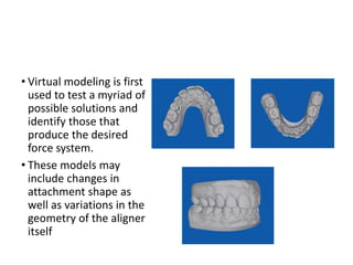 • Virtual modeling is first
used to test a myriad of
possible solutions and
identify those that
produce the desired
force system.
• These models may
include changes in
attachment shape as
well as variations in the
geometry of the aligner
itself
 