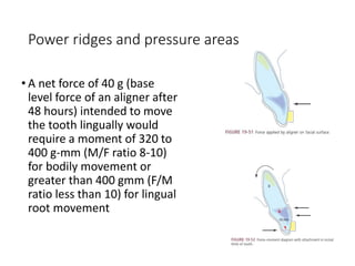 Power ridges and pressure areas
• A net force of 40 g (base
level force of an aligner after
48 hours) intended to move
the tooth lingually would
require a moment of 320 to
400 g-mm (M/F ratio 8-10)
for bodily movement or
greater than 400 gmm (F/M
ratio less than 10) for lingual
root movement
 