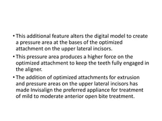 • This additional feature alters the digital model to create
a pressure area at the bases of the optimized
attachment on the upper lateral incisors.
• This pressure area produces a higher force on the
optimized attachment to keep the teeth fully engaged in
the aligner.
• The addition of optimized attachments for extrusion
and pressure areas on the upper lateral incisors has
made Invisalign the preferred appliance for treatment
of mild to moderate anterior open bite treatment.
 