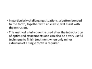 • In particularly challenging situations, a button bonded
to the tooth, together with an elastic, will assist with
the extrusion.
• This method is infrequently used after the introduction
of optimized attachments and can also be a very useful
technique to finish treatment when only minor
extrusion of a single tooth is required.
 
