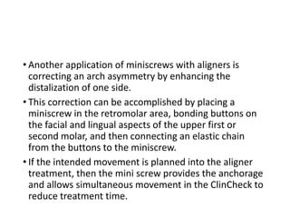 • Another application of miniscrews with aligners is
correcting an arch asymmetry by enhancing the
distalization of one side.
• This correction can be accomplished by placing a
miniscrew in the retromolar area, bonding buttons on
the facial and lingual aspects of the upper first or
second molar, and then connecting an elastic chain
from the buttons to the miniscrew.
• If the intended movement is planned into the aligner
treatment, then the mini screw provides the anchorage
and allows simultaneous movement in the ClinCheck to
reduce treatment time.
 