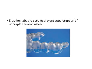 • Eruption tabs are used to prevent supereruption of
unerupted second molars
 