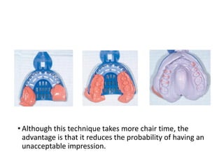 • Although this technique takes more chair time, the
advantage is that it reduces the probability of having an
unacceptable impression.
 
