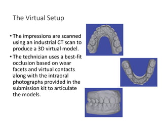The Virtual Setup
• The impressions are scanned
using an industrial CT scan to
produce a 3D virtual model.
• The technician uses a best-fit
occlusion based on wear
facets and virtual contacts
along with the intraoral
photographs provided in the
submission kit to articulate
the models.
 