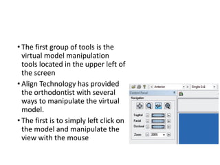 • The first group of tools is the
virtual model manipulation
tools located in the upper left of
the screen
• Align Technology has provided
the orthodontist with several
ways to manipulate the virtual
model.
• The first is to simply left click on
the model and manipulate the
view with the mouse
 