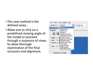 • The next method is the
defined views .
• Allow one to click on a
predefined viewing angle of
the model or proceed
through a sequence of views
to allow thorough
examination of the final
occlusion and alignment.
 