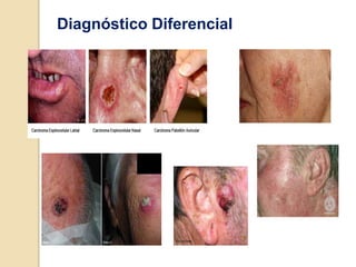 Diagnóstico Diferencial
 
