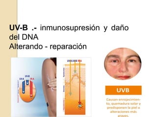 UV-B .- inmunosupresión y daño
del DNA
Alterando - reparación
 