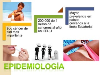 2do cáncer de
piel mas
importante
200 000 de 1
millón de
canceres al año
en EEUU
Mayor
prevalencia en
países
cercanos a la
línea Ecuatorial
 
