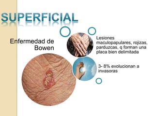 Enfermedad de
Bowen
3- 8% evolucionan a
invasoras
Lesiones
maculopapulares, rojizas,
parduzcas, q forman una
placa bien delimitada
 