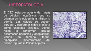 El CEC está compuesto de masas
de células neoplásicas que se
originan en la epidermis e infiltran la
dermis. Las células se pueden
agrupar y conformar nidos o infiltrar
como unidades aisladas. Dichos
nidos lo conforman células
escamosas normales y anaplasicas.
Varían en tamaño, forma,
hiperplasia, hipercromasia del
núcleo, figuras mitóticas atípicas.
 