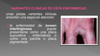 unas pocas variantes clínicas
ameritan una especial atención:
 la enfermedad de bowen
intertriginosa puede
presentarse como una placa
supurativa , eritematosa ,o
como una parche o placa
pigmentada
 