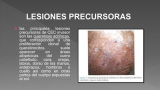  las principales lesiones
precursoras de CEC invasor
son las queratosis actínicas,
que corresponden a una
proliferación clonal de
queratinocitos. suele
aparecer en áreas
alopécicas del cuero
cabelludo, cara, orejas,
labios, dorso de las manos,
antebrazos, hombros o
cuello así como en otras
partes del cuerpo expuestas
al sol.
LESIONES PRECURSORAS
 
