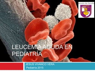 LEUCEMIA AGUDA EN
PEDIATRÍA
JESUS VIVANCO VERA
Pediatría 2015
 