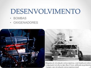 DESENVOLVIMENTO
• BOMBAS
• OXIGENADORES
 