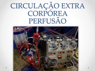 CIRCULAÇÃO EXTRA
    CORPÓREA
    PERFUSÃO
 