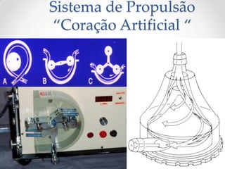 Sistema de Propulsão
“Coração Artificial “
 