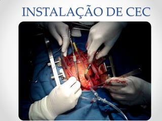 INSTALAÇÃO DE CEC
 