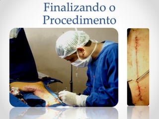 Finalizando o
Procedimento
 