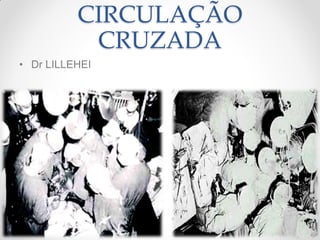 CIRCULAÇÃO
           CRUZADA
• Dr LILLEHEI
 