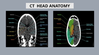 Contrast Enhanced Computed Tomography Brain ppt | PPTX