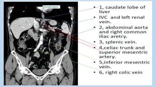 Absccess Triphasic Ct Scan Abdominal CT scan, Triphasic CT scan, Abdominal Anatomy and ...