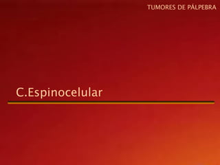 C.Espinocelular
TUMORES DE PÁLPEBRA
 