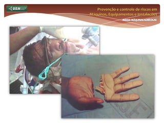 Prevenção e controle de riscos em Máquinas, Equipamentos e InstalaçõesMódulo MÁQUINAS AGRÍCOLASQuem é o trabalhador rural? Por não ser possível definir quem é o trabalhador rural, dado o universo disponível, devemos abrir mão de práticas de Diagnóstico do Trabalhador Rural, que considerem:Questões sobre psicologia do trabalho;