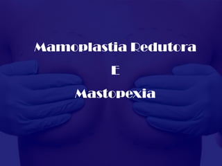 Mamoplastia Redutora
         E
     Mastopexia
 