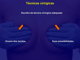 Técnicas cirírgicas


             Escolha da técnica cirúrgica adequada




Exame dos tecidos                       Suas possibilidades
 
