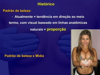 Histórico
Padrão de beleza:
     - Atualmente = tendência em direção ao meio
   termo, com visual baseado em linhas anatômicas

                naturais = proporção




Padrão de beleza x Midia
 