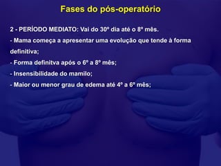 Fases do pós-operatório

2 - PERÍODO MEDIATO: Vai do 30º dia até o 8º mês.
- Mama começa a apresentar uma evolução que tende à forma
definitiva;
- Forma definitva após o 6º a 8º mês;
- Insensibilidade do mamilo;
- Maior ou menor grau de edema até 4º a 6º mês;
 