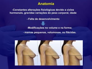 Anatomia
  -Constantes alterações fisiológicas devido a ciclos
hormonais, gravidez variações do peso corporal, idade

             - Falta de desenvolvimento


             -Modificações no volume e na forma;
          - mamas pequenas, volumosas, ou flácidas.
 