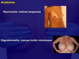 Anatomia


 Hipomastia: mamas pequenas




Gigantomastia: mamas muito volumosas
 