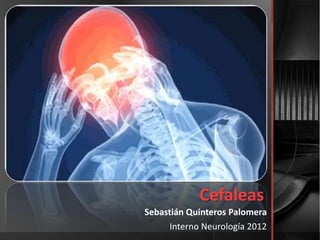 Cefaleas
Sebastián Quinteros Palomera
      Interno Neurología 2012
 